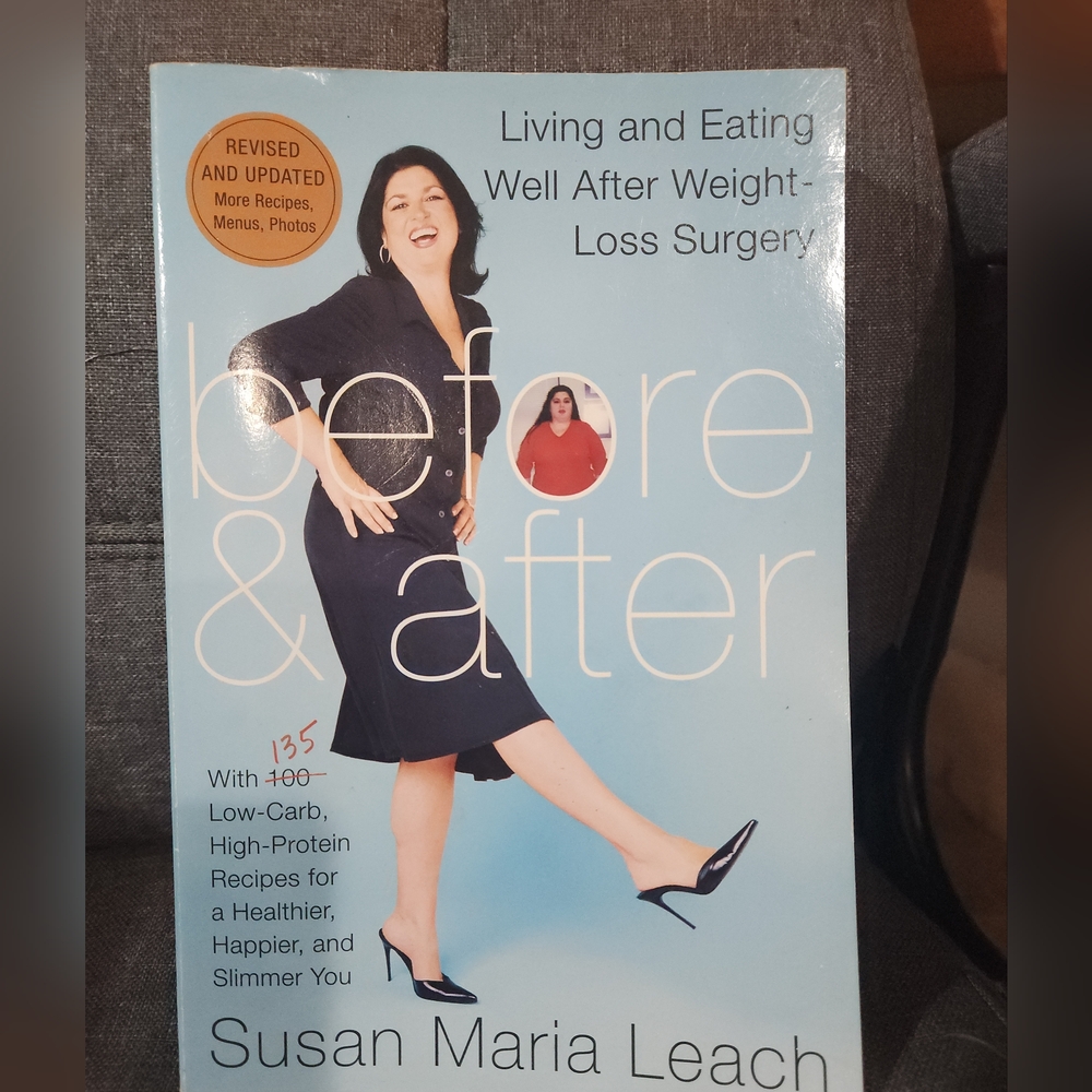 Before & After Post Bariatric Surgery by Susan Maria Leach